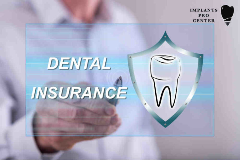 What Dental Plans Cover Implants Dental News Network