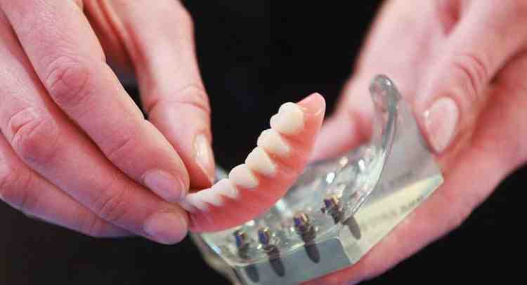 What Happens If You Leave Your Dentures In All The Time Dental News