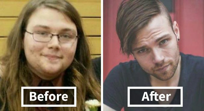 before-after-pics