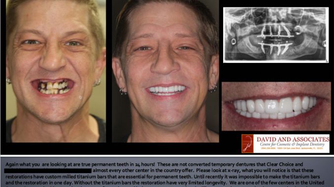 clear-choice-dentures