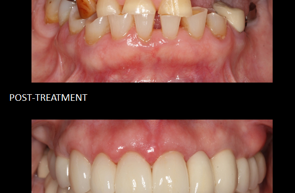 cosmetic-dental