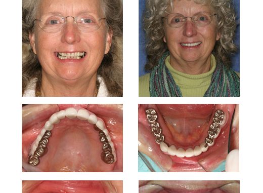 cosmetic-dentistry-grant