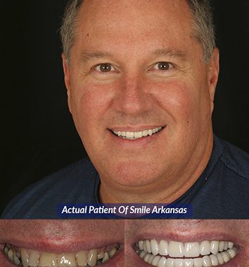 cosmetic-dentistry-little-rock