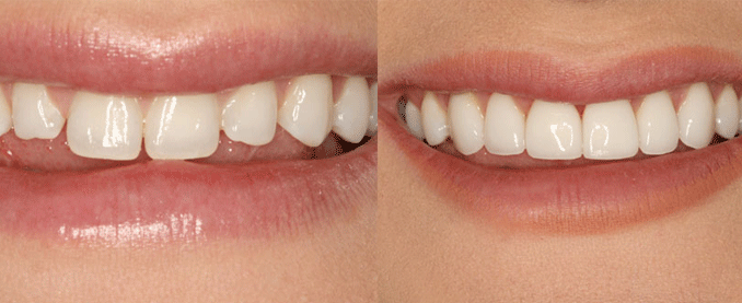 cosmetic-dentistry-pittsburgh