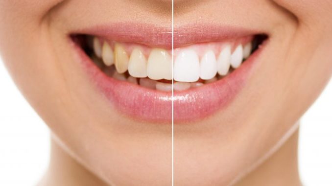 cosmetic-dentistry-vancouver-wa