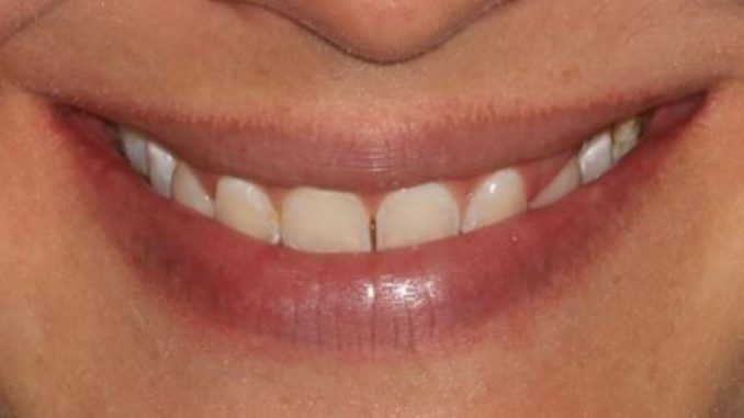cosmetic-dentistry-vienna-va