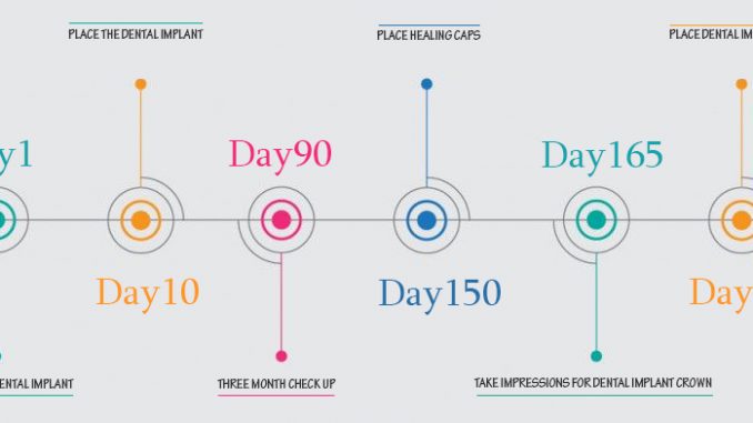 dental-implant-procedure-timeline