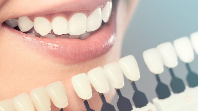 dental-treatments