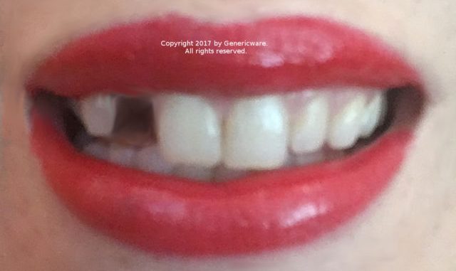 fix-teeth