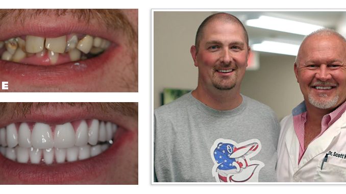 getting-teeth-fixed