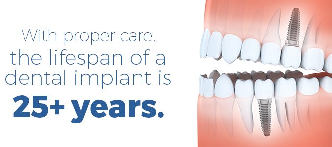 how-long-do-dental-implants-last