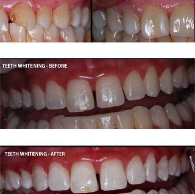 how-much-do-cosmetic-dentists-make