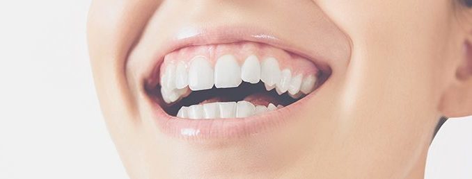 how-much-do-fake-teeth-cost
