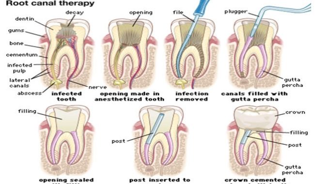 types-of-dental-procedures