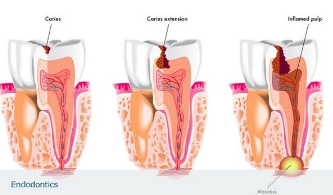 types-of-dental-surgeries