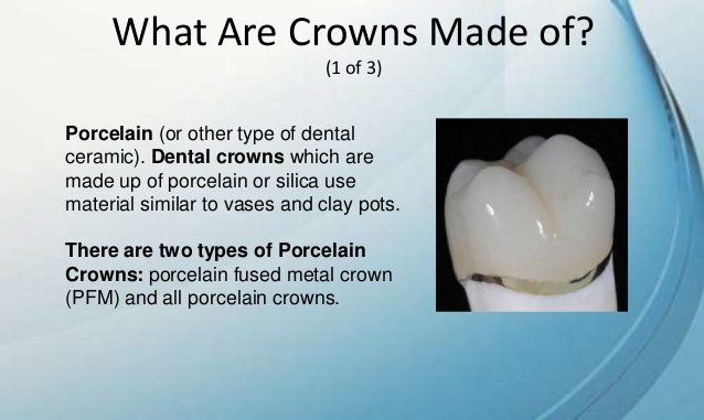 what-are-crowns-made-of
