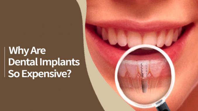 why-are-dental-implants-so-expensive