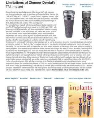 zimmer-dental-implants