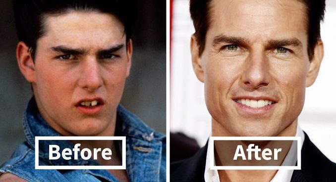 before-after-pictures