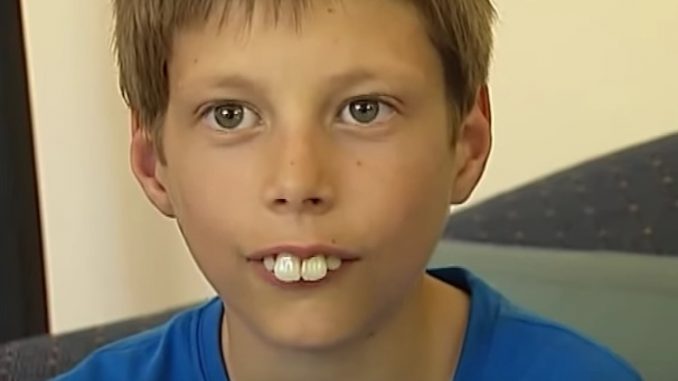 buck-teeth-image