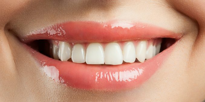 can-you-whiten-fake-teeth