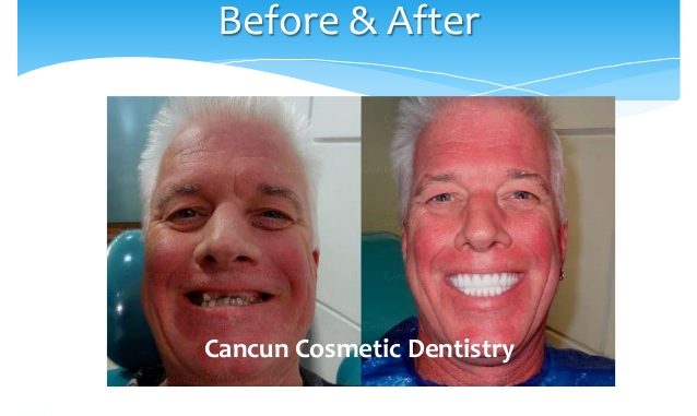 cancun-cosmetic-dentistry