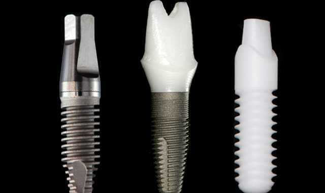ceramic-dental-implants