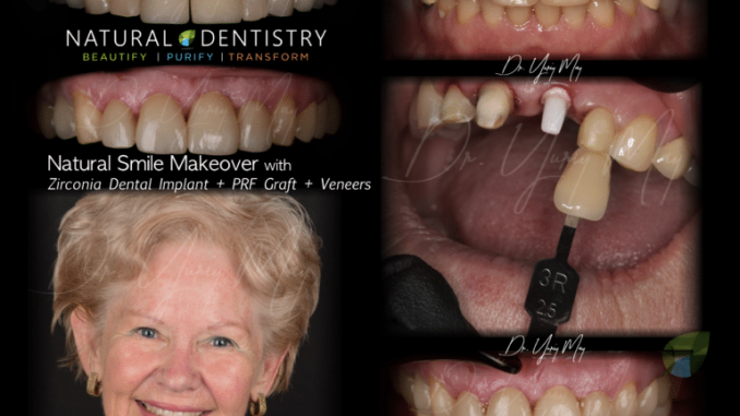 cosmetic-and-natural-dentistry