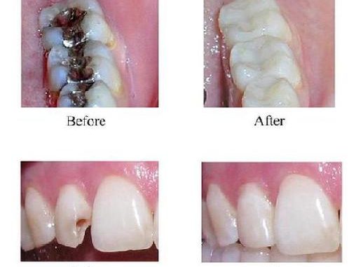cosmetic-dentistry-austin-tx