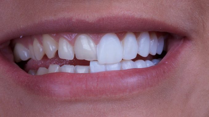 cosmetic-dentistry-boston