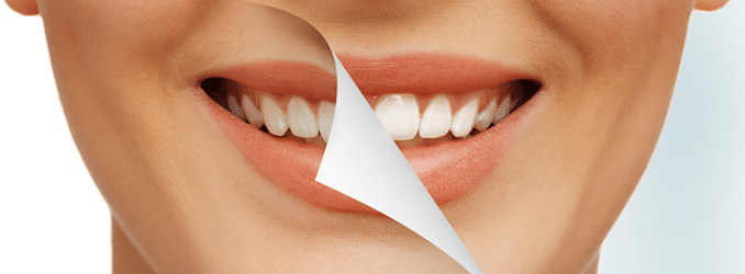 cosmetic-dentistry-chandler-az