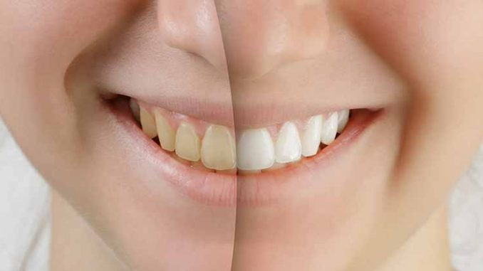 cosmetic-dentistry-las-vegas-nv