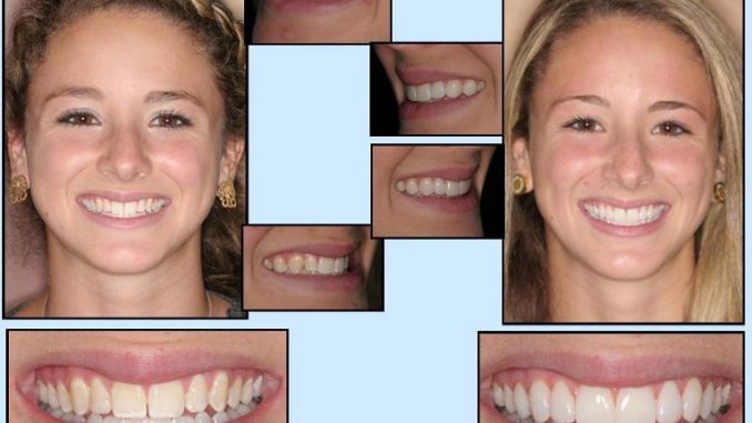 cosmetic-dentistry-orlando