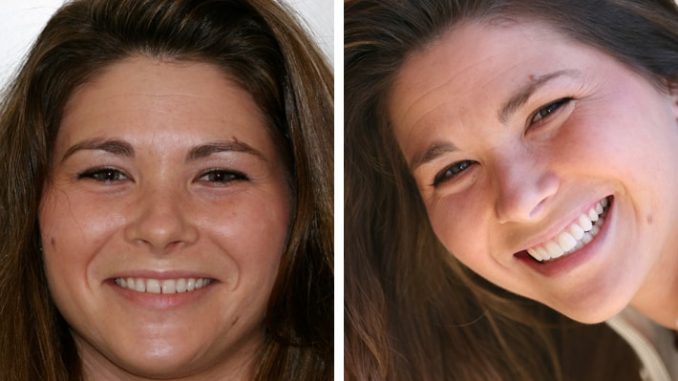 cosmetic-dentistry-raleigh