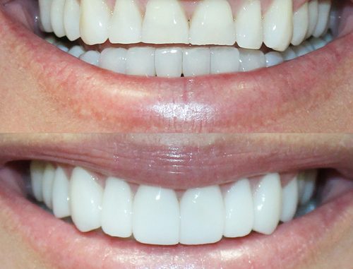 cosmetic-dentistry-san-antonio-tx
