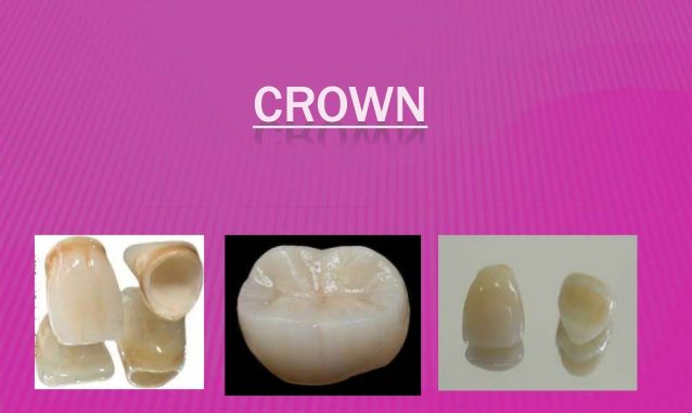 crown-teeth-definition
