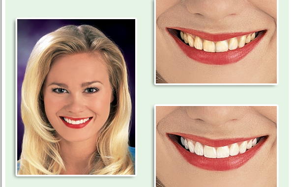 dallas-cosmetic-dentistry