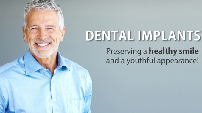 dental-implants-michigan