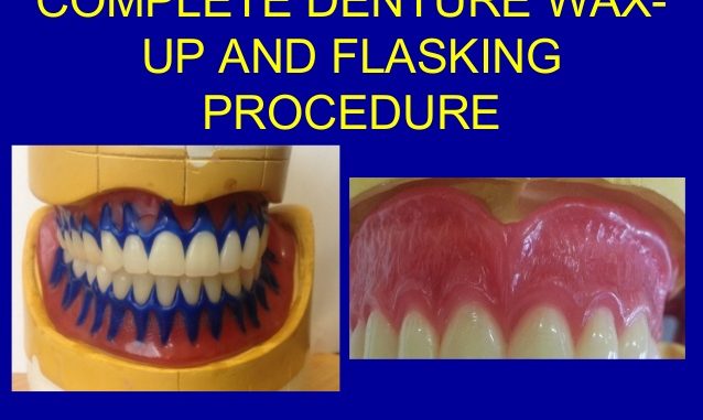 denture-procedure