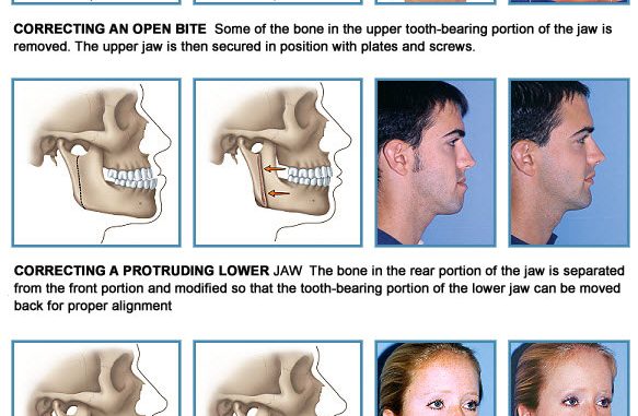 do-orthodontists-do-surgery