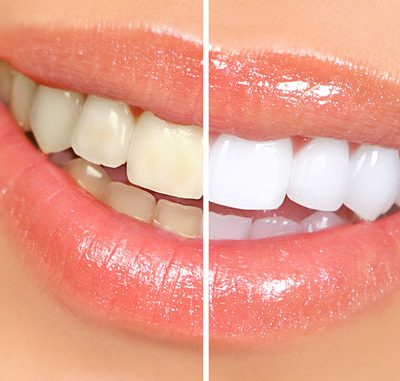 fix-your-smile