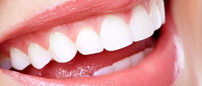 free-cosmetic-dentistry