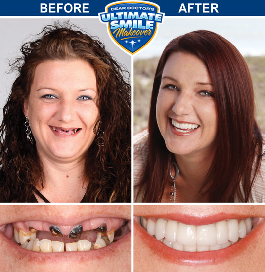 Free Dental Makeover Dental News Network