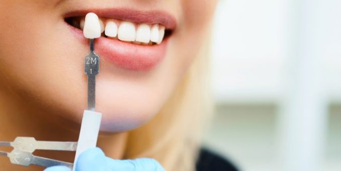 how-long-does-a-dental-implant-procedure-take