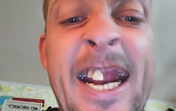 i-need-my-teeth-fixed