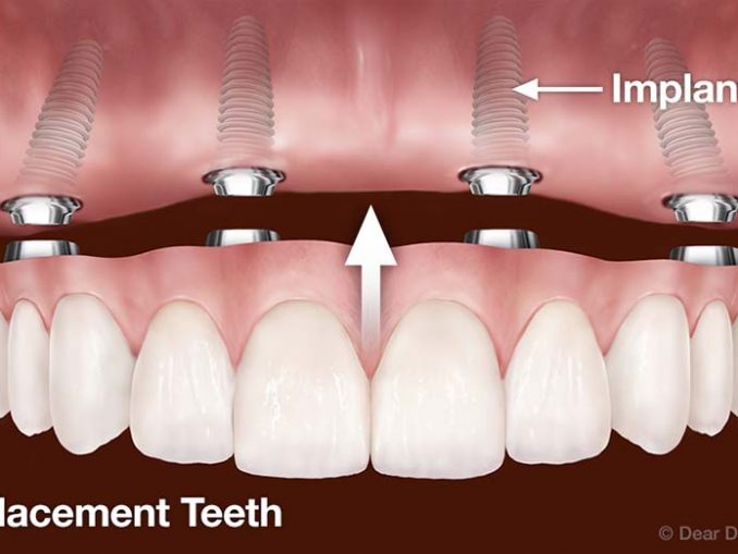 Medical Dds Abbreviation