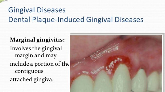 periodontist-meaning