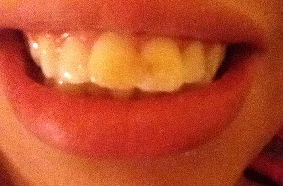 pretty-teeth