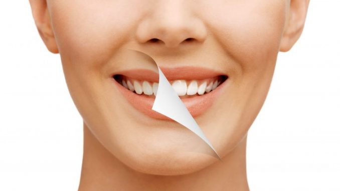 smile-make-over
