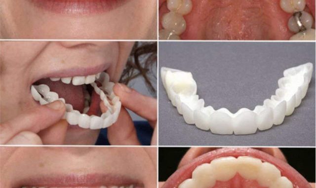 snap-it-tooth